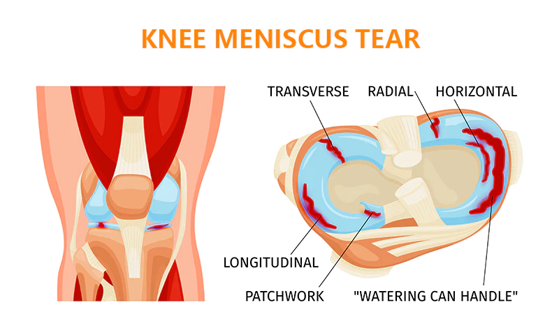 GFOUK Bee Venom Joint and Bone Therapy Spray
