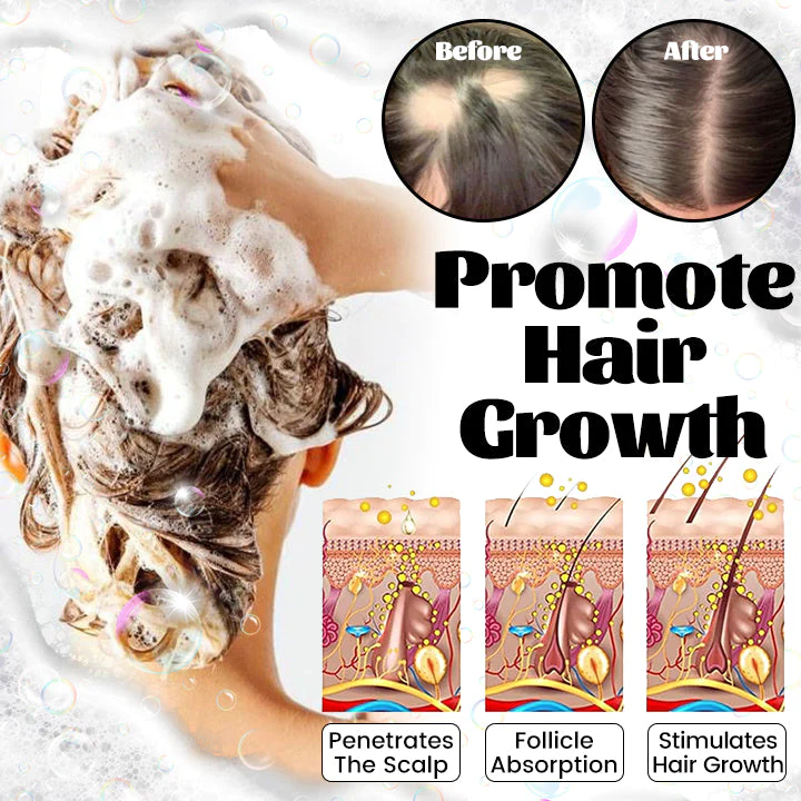 Ceoerty RevitaGinger Hair Boost Shampoo Bar