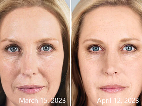 RenewalTouch Korean Collagen Firming Mask