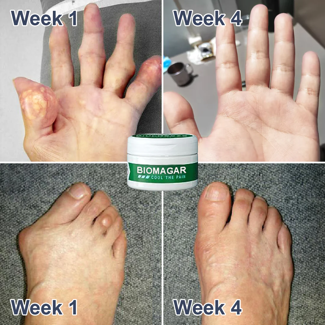 Oveallgo PRO Bee Venom Pain and Bone Healing Cream