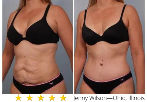 FitPlus Skin Tightening Spray