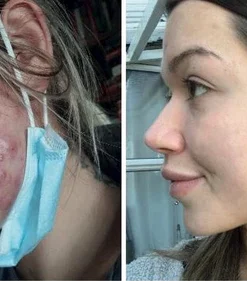 flysmus Advanced Scar Repair Serum