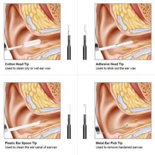 HD 3in1 Ear Cleaning Kit