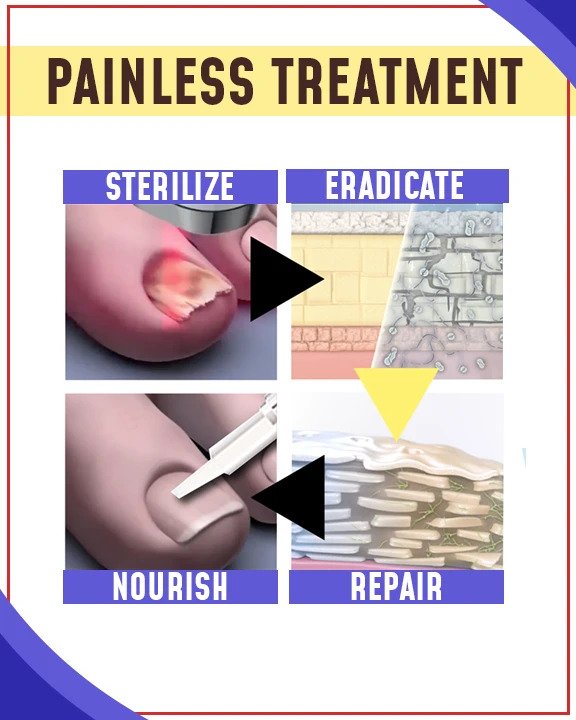 Anti-Fungal Blue Light Treatment Sets