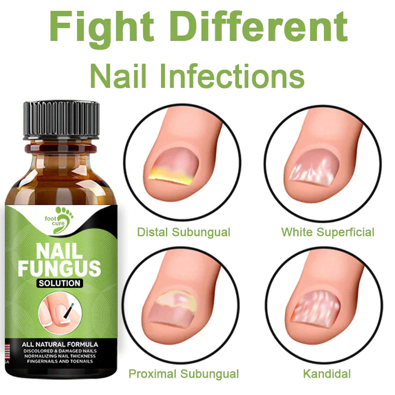 Fivfivgo FootCure Removal Paronychia Gel