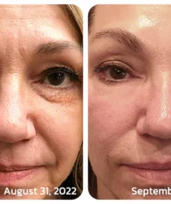 Ceoerty Milia Erase Lifting Eye Gel