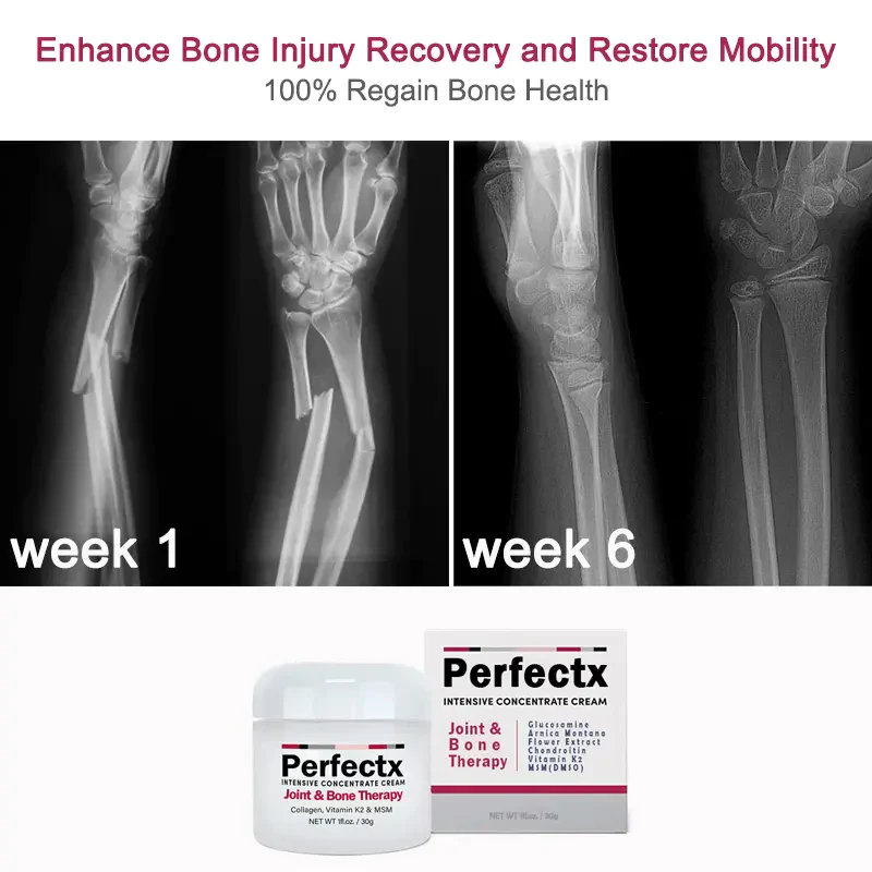 Perfectx Joint & Bone Therapy Cream