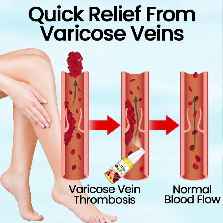 Ceoerty VeinMist Varicose Vein Spray