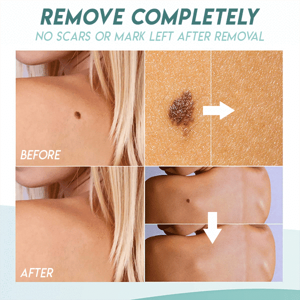 23-in-1 Multi-Purpose Folding Shovel