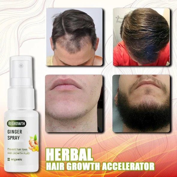GingerGrowth Anti-Hair Loss Spray