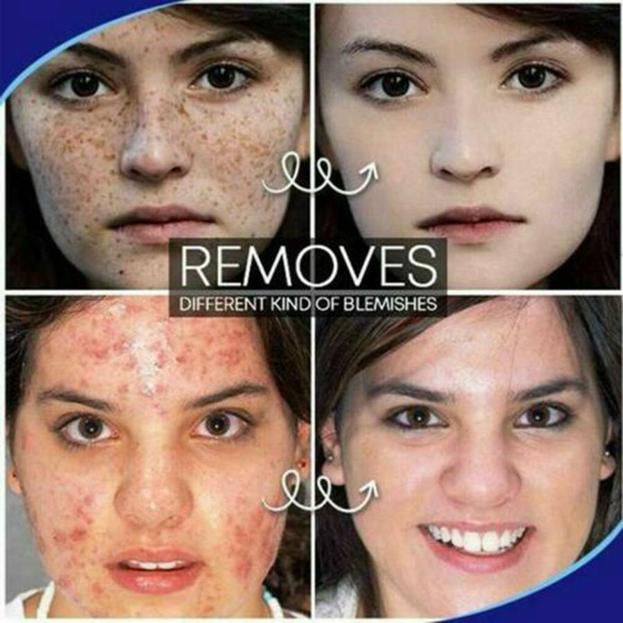 TagOut Spot Removal Cream