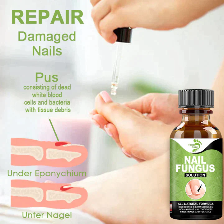 Fivfivgo FootCure Removal Paronychia Gel