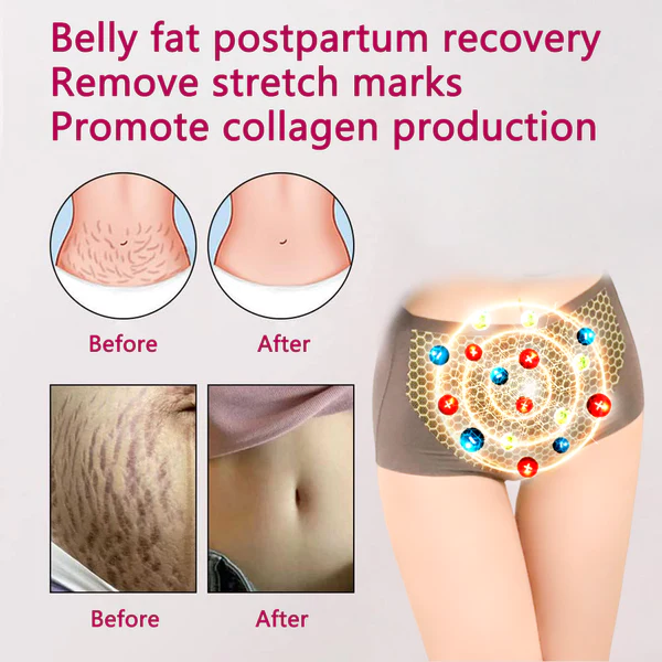 ANYIDEA Magnetic Nano Ion Fat Burning Belly Controlling Detoxifying Shaper