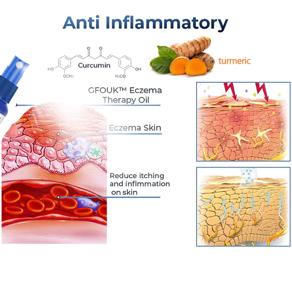 PsoriaGone Psoriasis Relief Spray