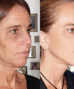 Pedia Advanced Collagen Boost Anti Aging Serum