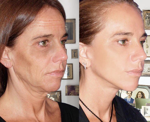 RIOEFFECT 30 Day Anti-Aging Treatment Serum