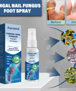 Furzero Medical Grade Fungal Nail Fungus Foot Spray