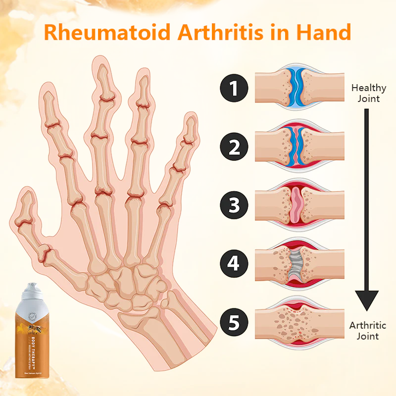 GFOUK Bee Venom Joint and Bone Therapy Spray