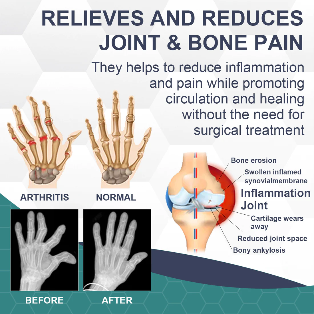 IFMAGIC Bee Venom Pain and Bone Healing Cream