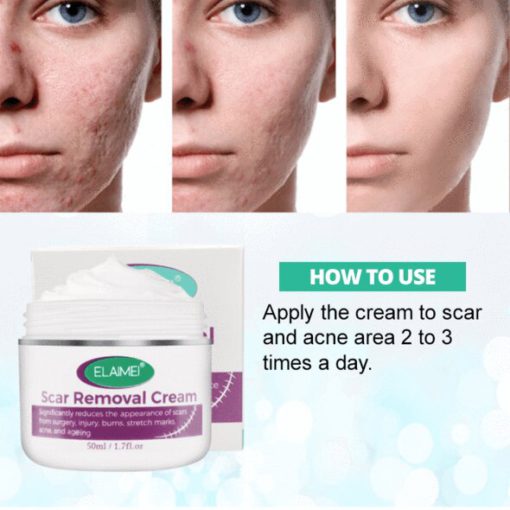 Skin Rebound Scarless Cream