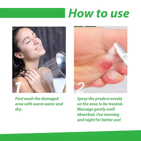 Pedimend Corn Remover Spray