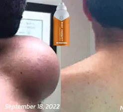 GFOUK Bee Venom Joint and Bone Therapy Spray