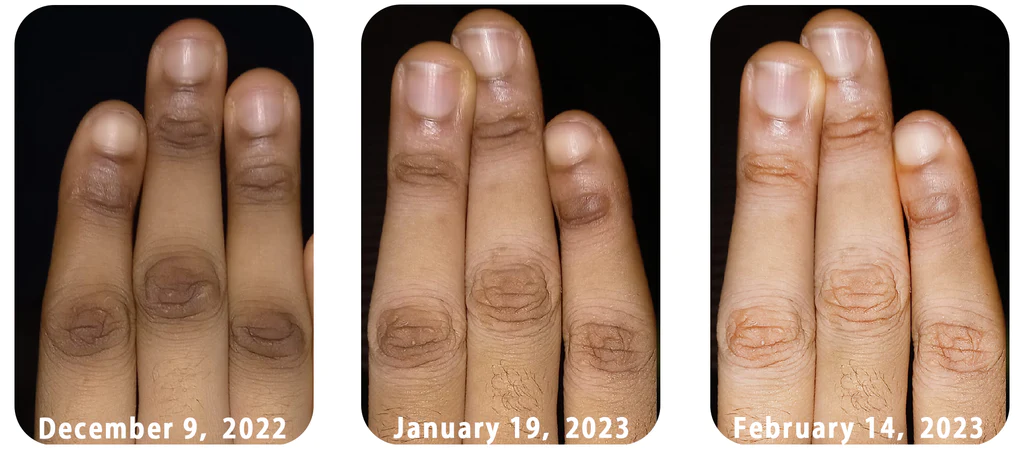 GFOUK AcanthoGlow Therapy Cream