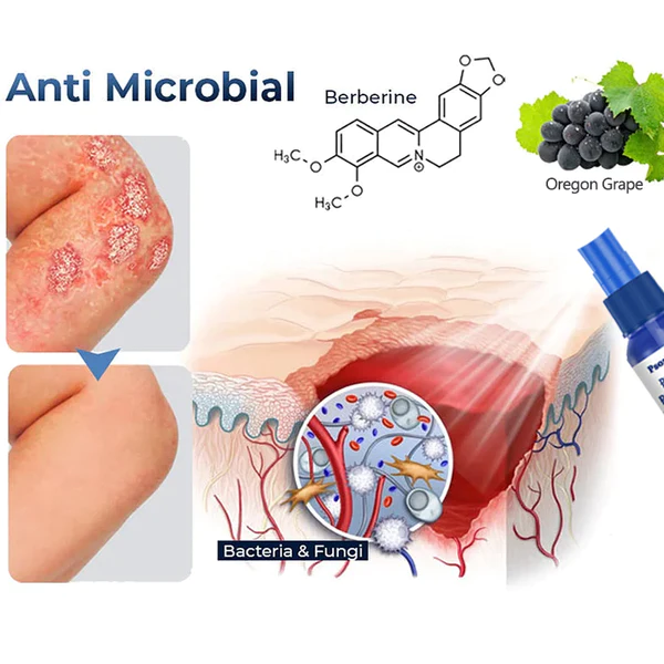 PsoriaGone Psoriasis Relief Spray
