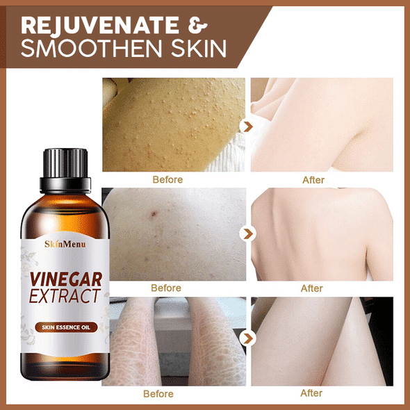 Vinegar Extract Skin Tightener