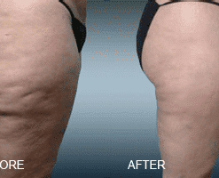 Volcanic Clay Coffee Slimming Soap Bar