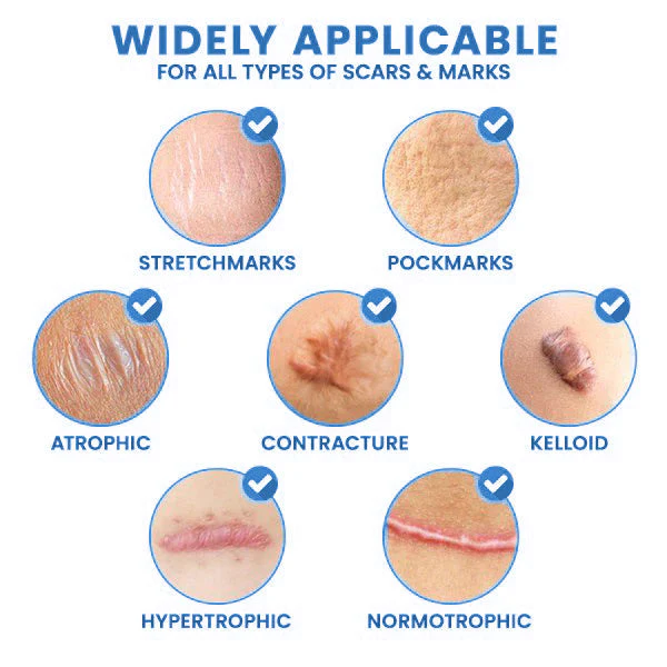 ScarFree Professional Advanced Cool Scar Treatment