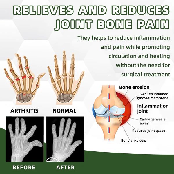 Cvreoz Australian Honey Bee Venom Pain and Bone Healing Cream