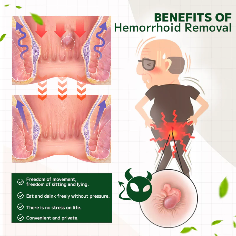 Lotmay Maximum Strength Hemorrhoids and Fissure Ointment