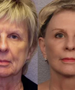 Nuves MMP Anti-Wrinkle Antioxidant Serum