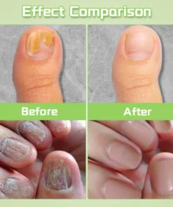 Ceoerty PROStrength Ultimate Nail Repair Serum