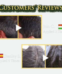 Anti-Skid Cable Ties for Vehicles