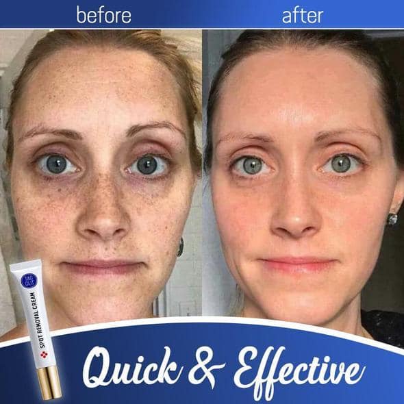 TagOut Spot Removal Cream