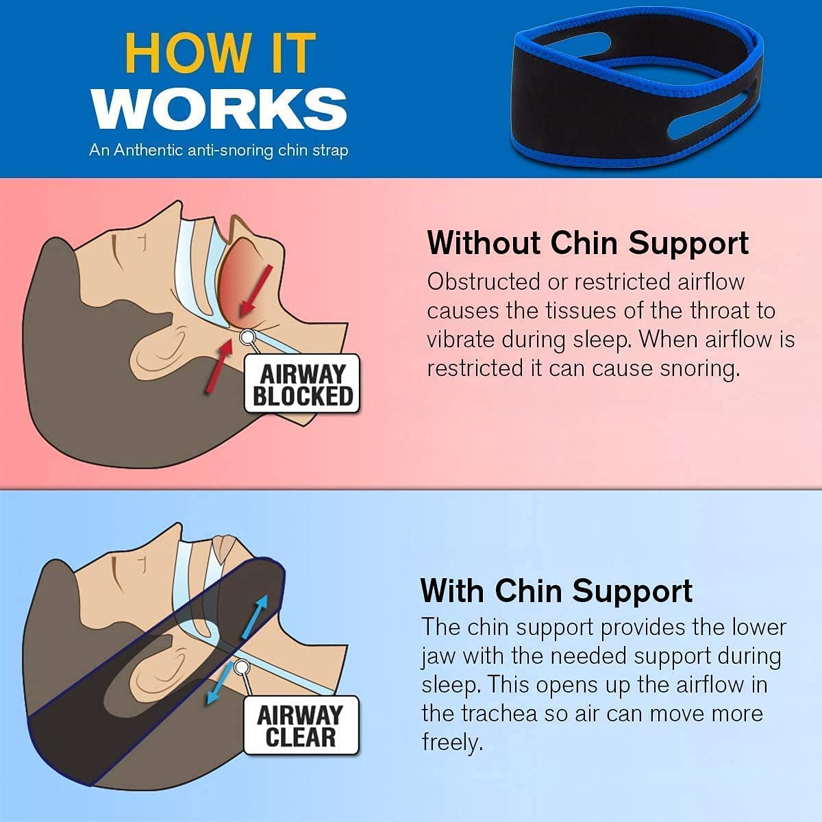 Anti Snoring Solution