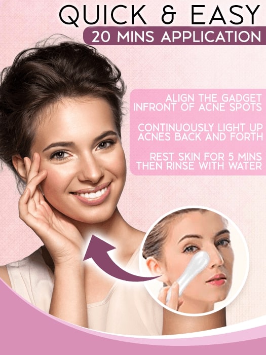 Acne Clearing Light Therapy