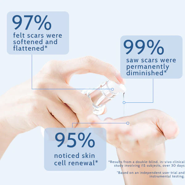 ScarFree Professional Advanced Cool Scar Treatment