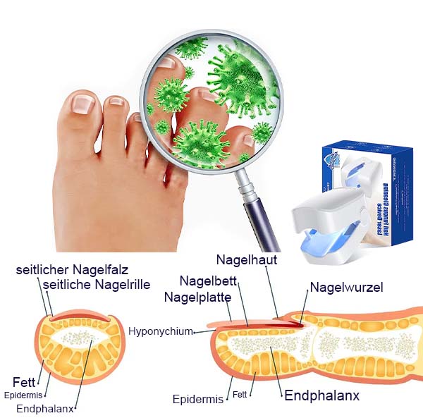 Furzero Nail Fungus Laser Treatment Device