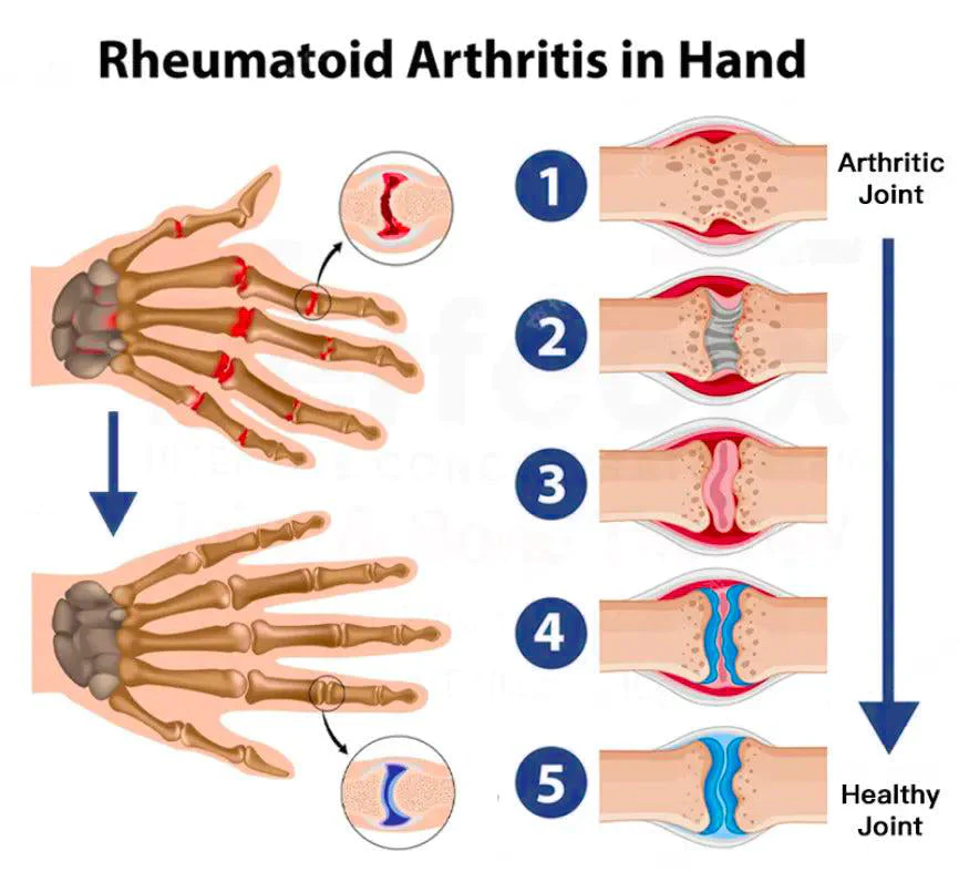FeiJoint Natural Powerful Roll-on Relief Gel