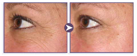 RenewalTouch Korean Collagen Firming Mask