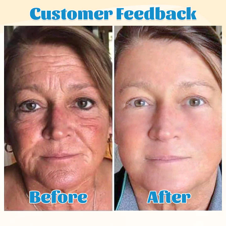 Blossom B5 Revitalift Anti-Wrinkle Serum