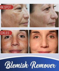 TagOut Spot Removal Cream