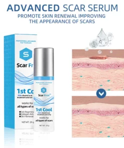 ScarFree Professional Advanced Cool Scar Treatment