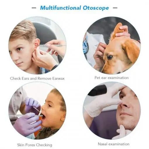 HD 3in1 Ear Cleaning Kit