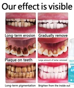 PlaqBite Plaque Removal Anti-Cavity Mousse Toothpaste