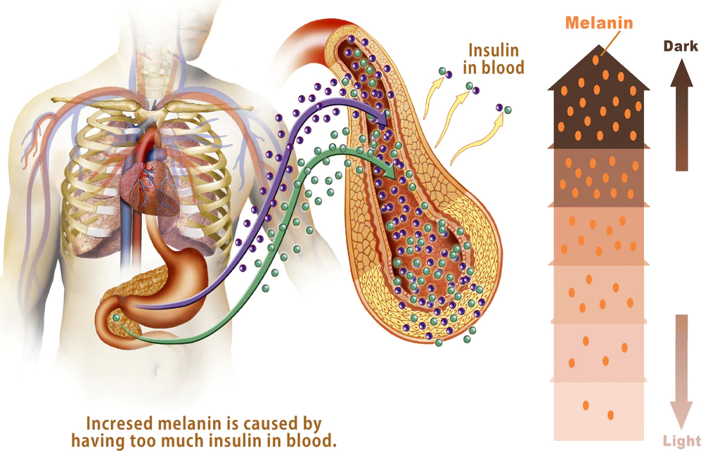 GFOUK AcanthoGlow Therapy Cream