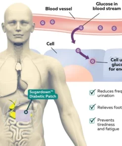 Oveallgo Sugardown Diabetic Patch Plus